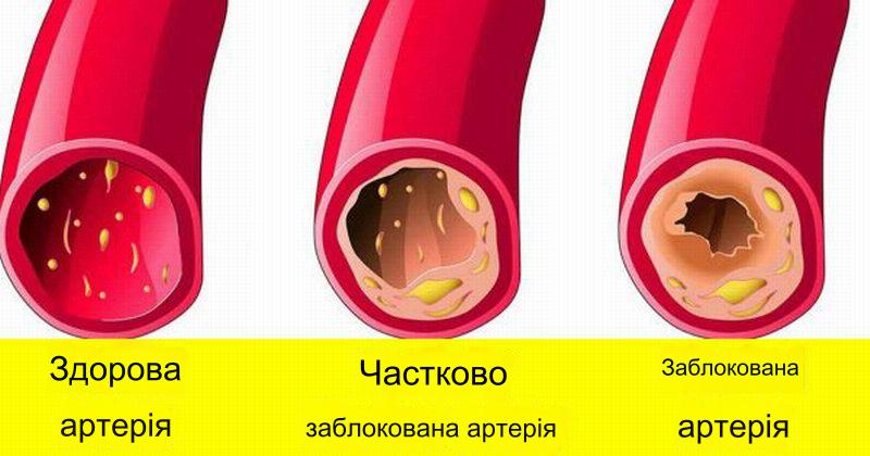 Як покращити кровообіг